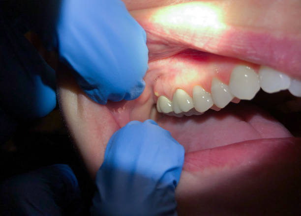 Best Weekend Emergency Dentist in San Castle, FL