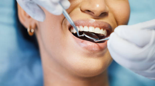 Best Broken or Cracked Tooth Emergency Dentist in San Castle, FL