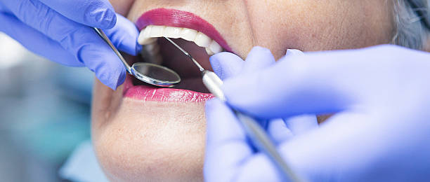 Best Emergency Dentist for Knocked-Out Tooth in San Castle, FL